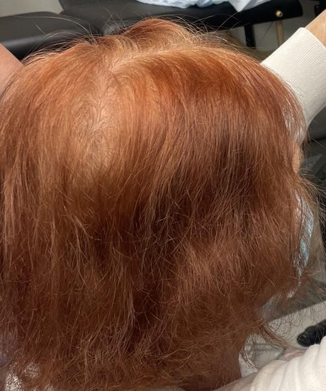 Before: thinning crown with planning lines, top view